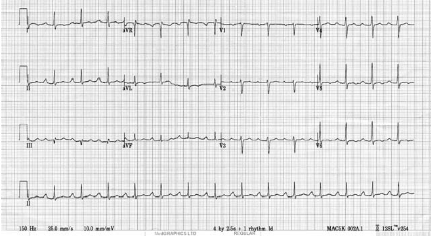 Screen Shot 2019-04-23 at 8.37.53 PM.png